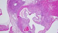 cross section of the heart